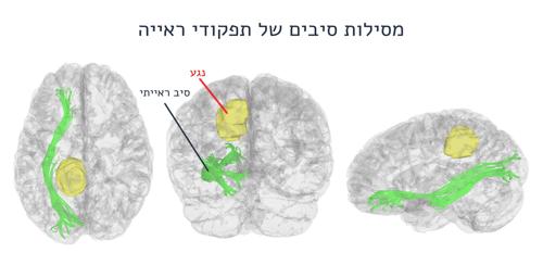 DTI1